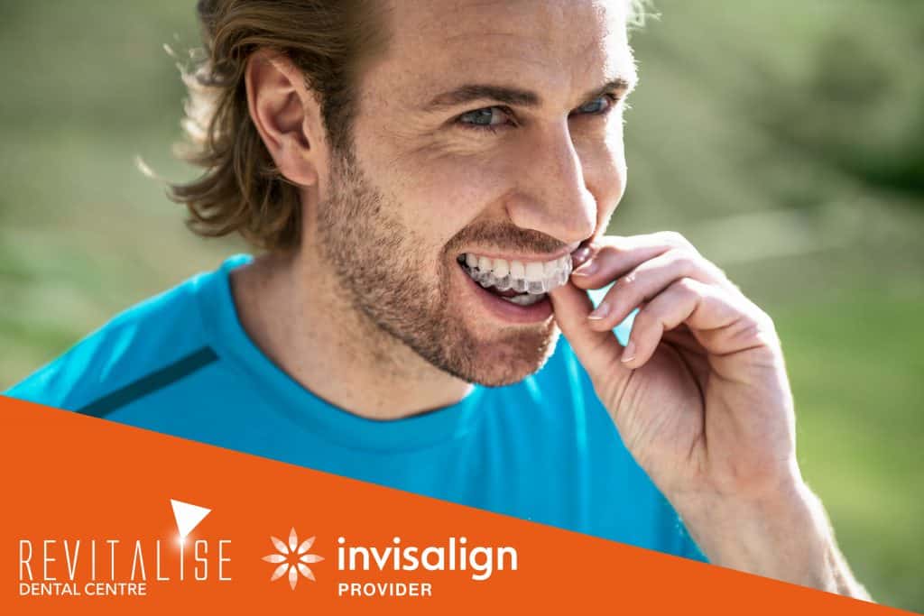 How Much Does Invisalign Cost - Revitalise Dental Centre