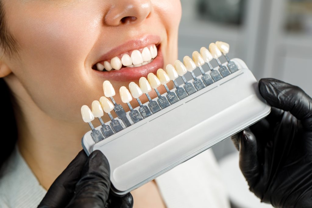 Preventing sensitive teeth when whitening - Revitalise Dental Centre